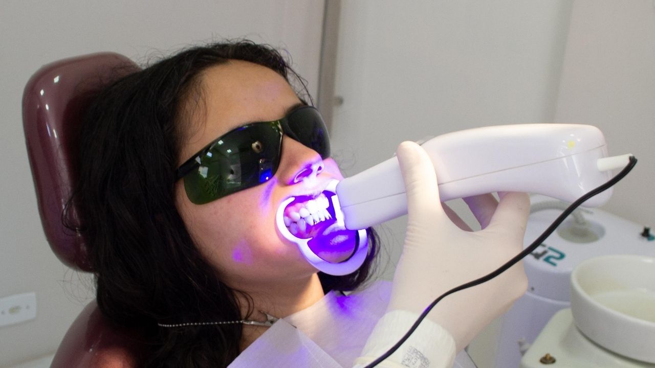 Teeth Whitening